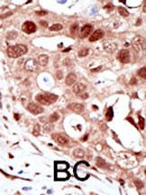 IHC-P - SUMO2 Antibody (C-term) AP1282a